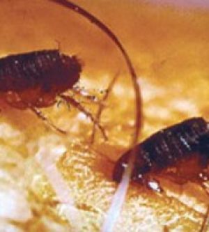 Are fleas in Orange County California? You bet!