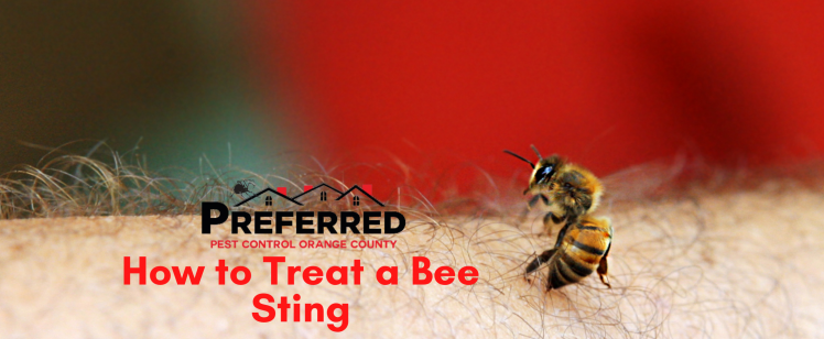 How to Treat a Bee Sting?